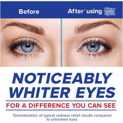 Clear Eyes Gotas para los ojos para aliviar el enrojecimiento máximo